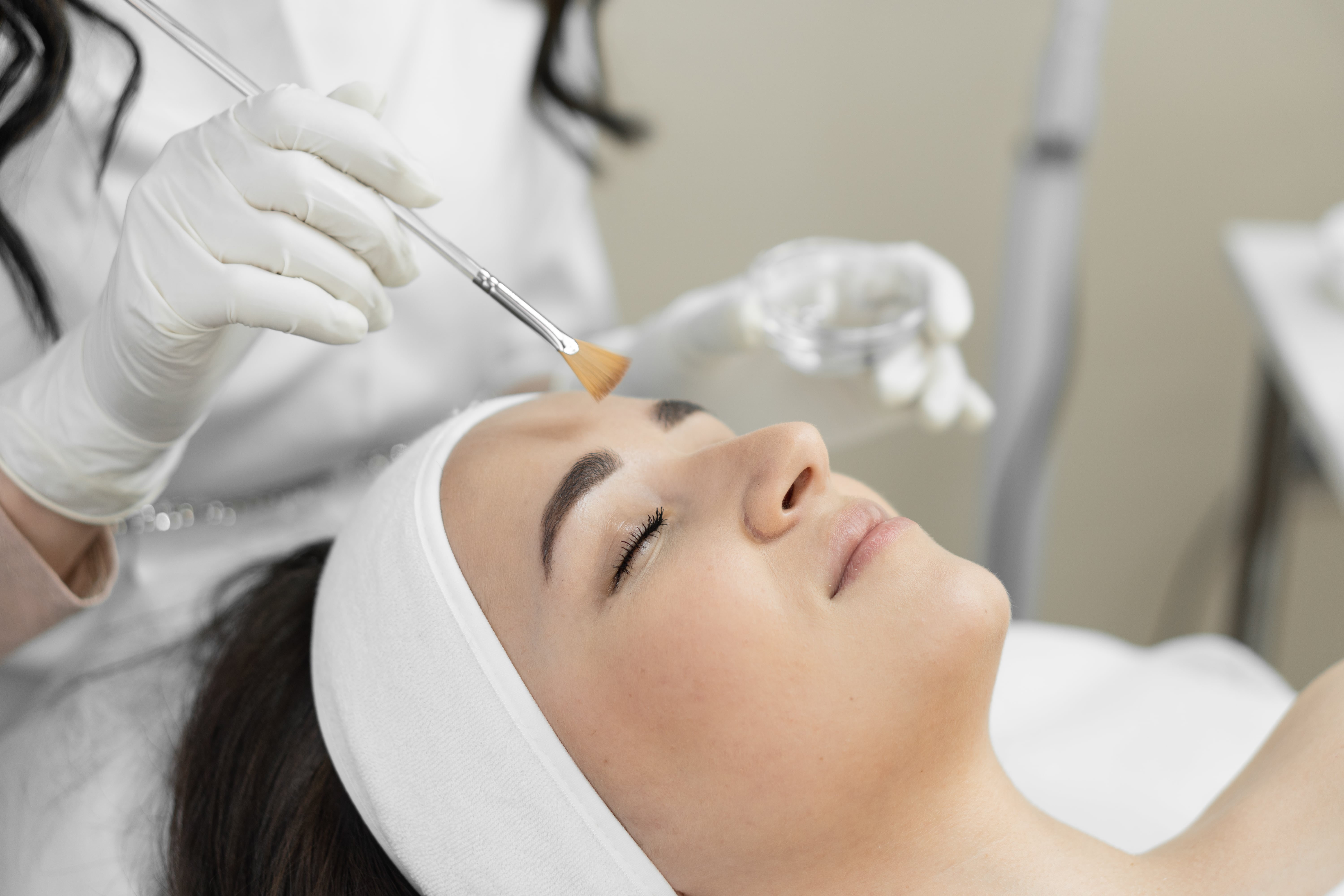 Hormonal Acne Treatment At Aesthetic Beauty By Lorraine