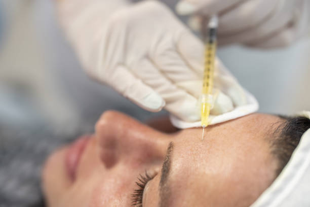 Microneedling At Aesthetic Beauty By Lorraine